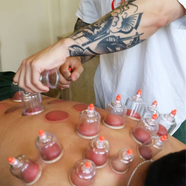 Feel Good Acupuncture &amp; Wellness