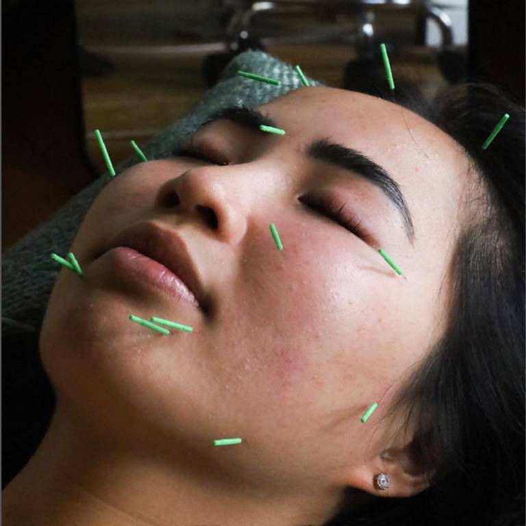 Feel Good Acupuncture &amp; Wellness